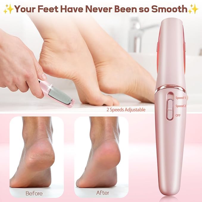 Professional Electric Callus Remover & Foot Scrubber – Smooth, Effortless Pedicure